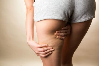 Cellulite reduzieren - Ratgeber: die besten übungen gegen Cellulite